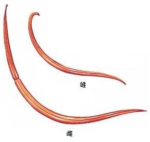 揭秘:人体最致命十大寄生虫