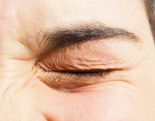 细纹干纹——视觉衰老:3岁