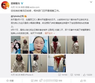 曝华师女生昆明被打 满脸是血被缝6针