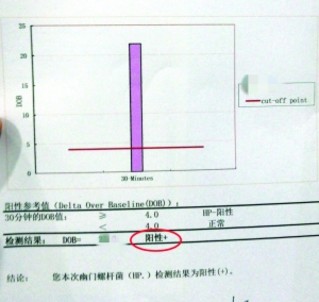 郑性人口_郑姓(2)